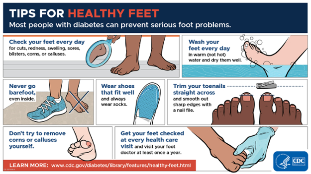 Tips for foot care